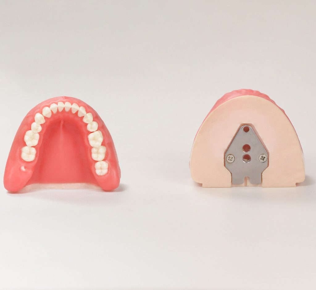 training model for tooth extraction