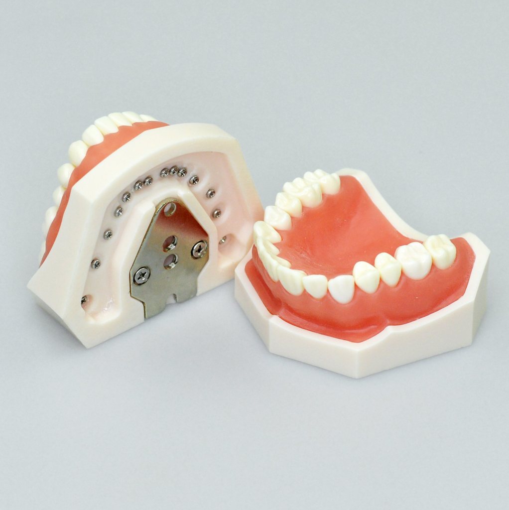 tooth preparation model