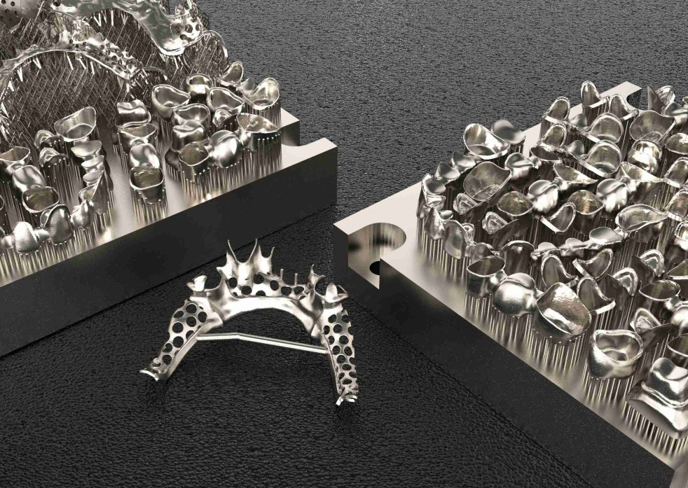 3d printer fabricates metal prostheses